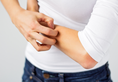 Atopijski dermatitis prehrana